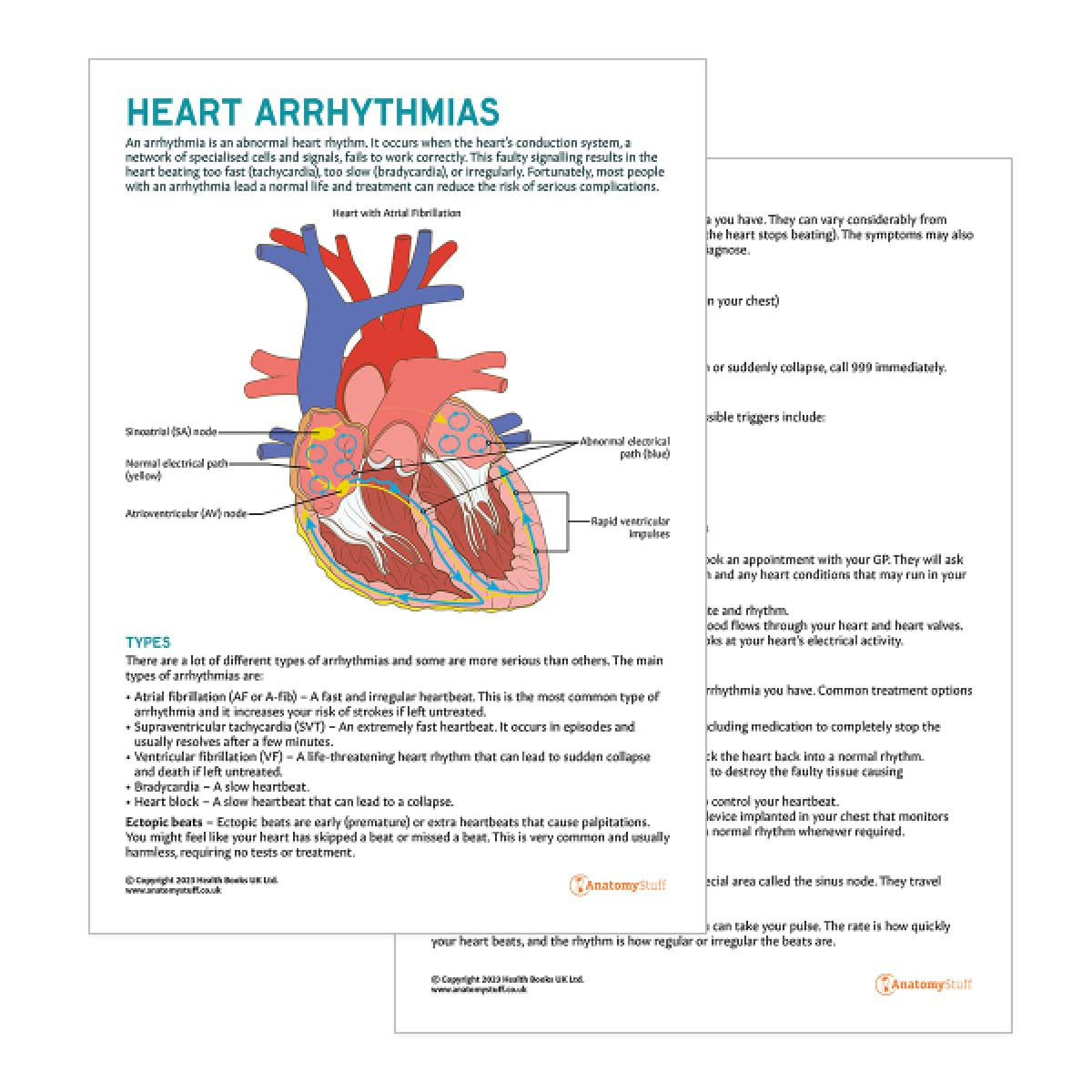 Printable Heart Arrhythmias Patient Leaflet | Patient Education PDF ...