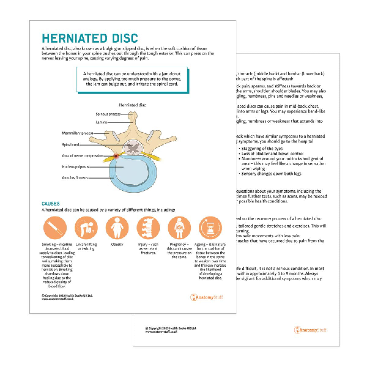 Herniated Disc Patient Education Handout (Printable PDF)