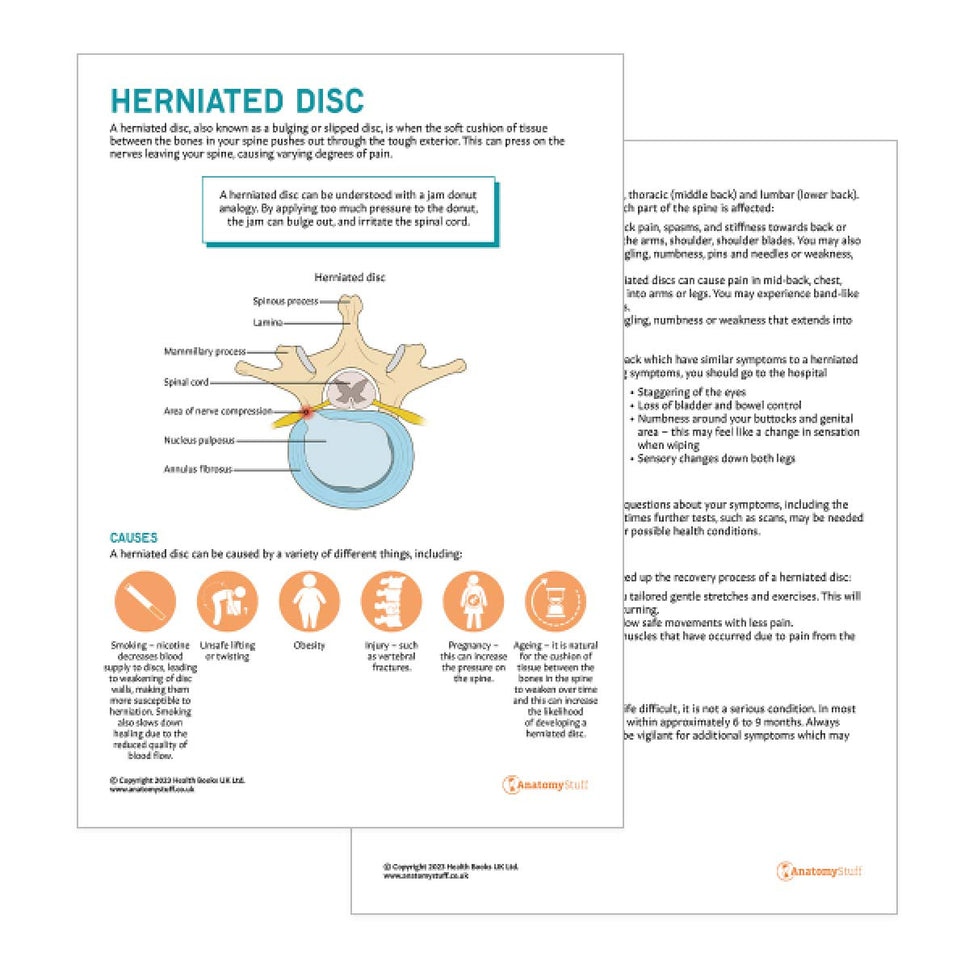 Herniated Disc Patient Education Handout (Printable PDF)