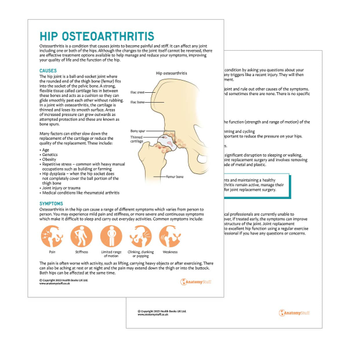 Hip Osteoarthritis Patient Education Handout (Printable PDF)