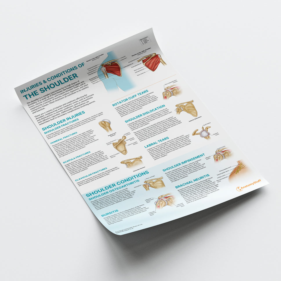 Injuries & Conditions of the Shoulder Chart / Poster