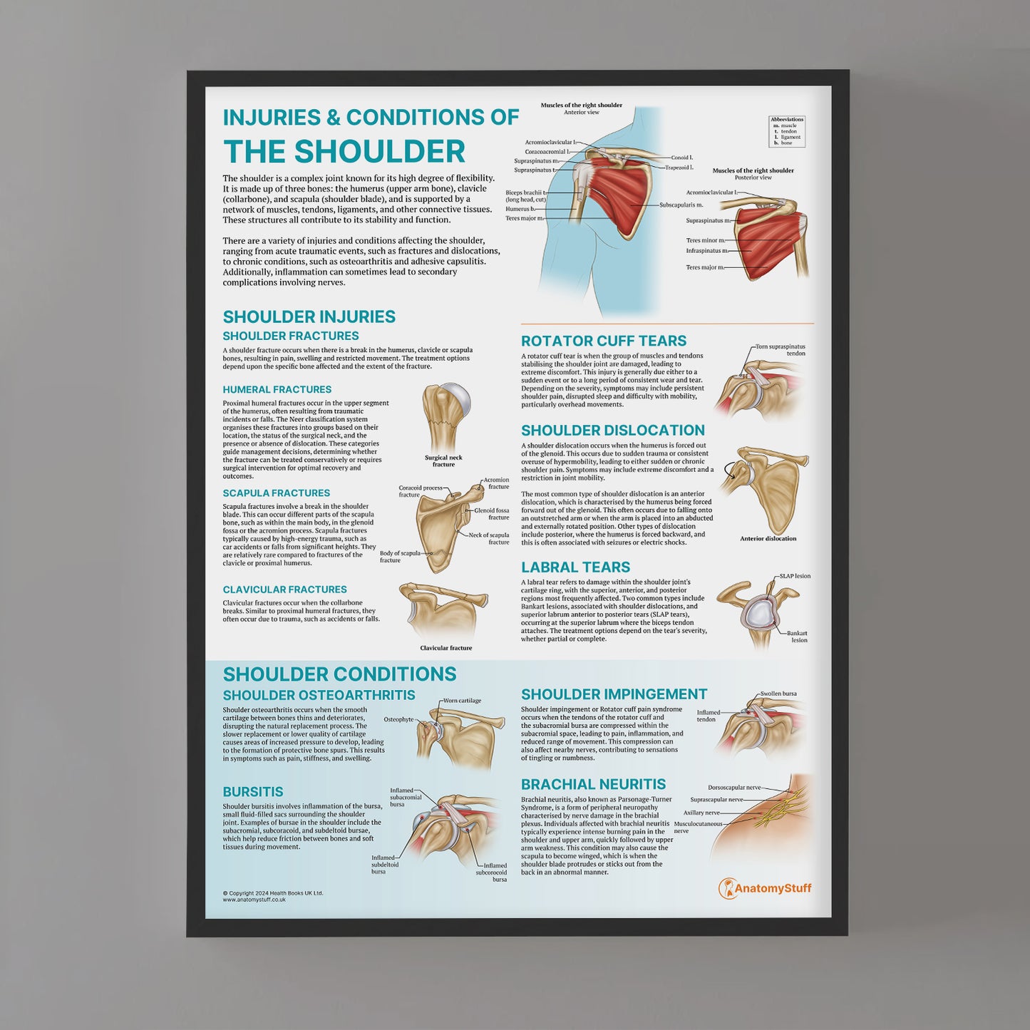 Injuries & Conditions of the Shoulder Chart / Poster