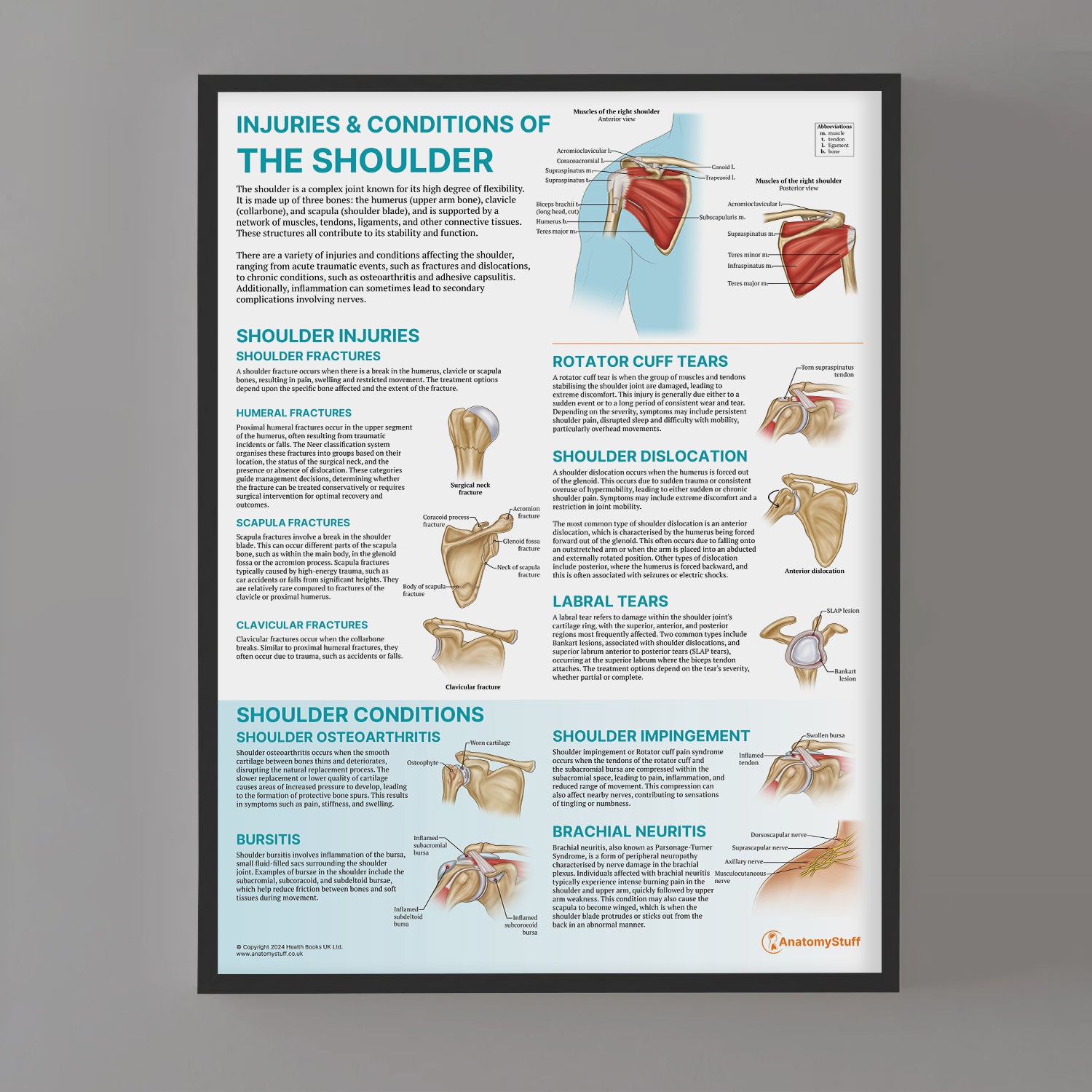 Injuries & Conditions of the Shoulder Chart / Poster