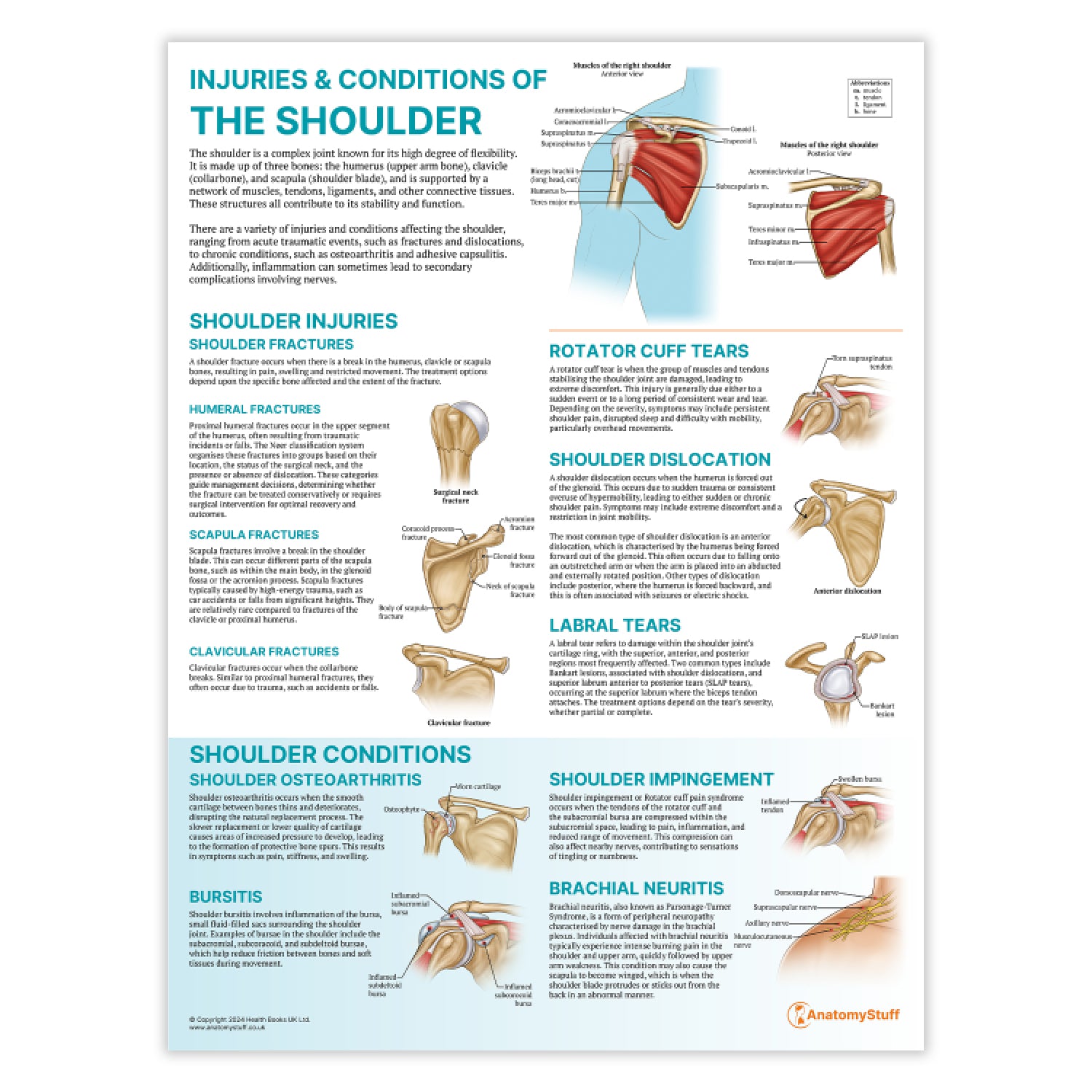 Shoulder Pain Chart.pdf Injuries & Conditions of the Shoulder Poster | Shoulder Anatomy Chart ...