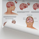 Switch Injuries Of The Brain Chart / Poster 3 image
