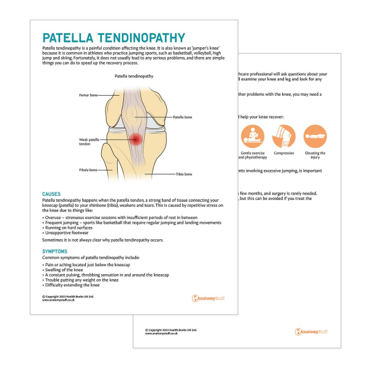Patella Tendinopathy Patient Education Handout