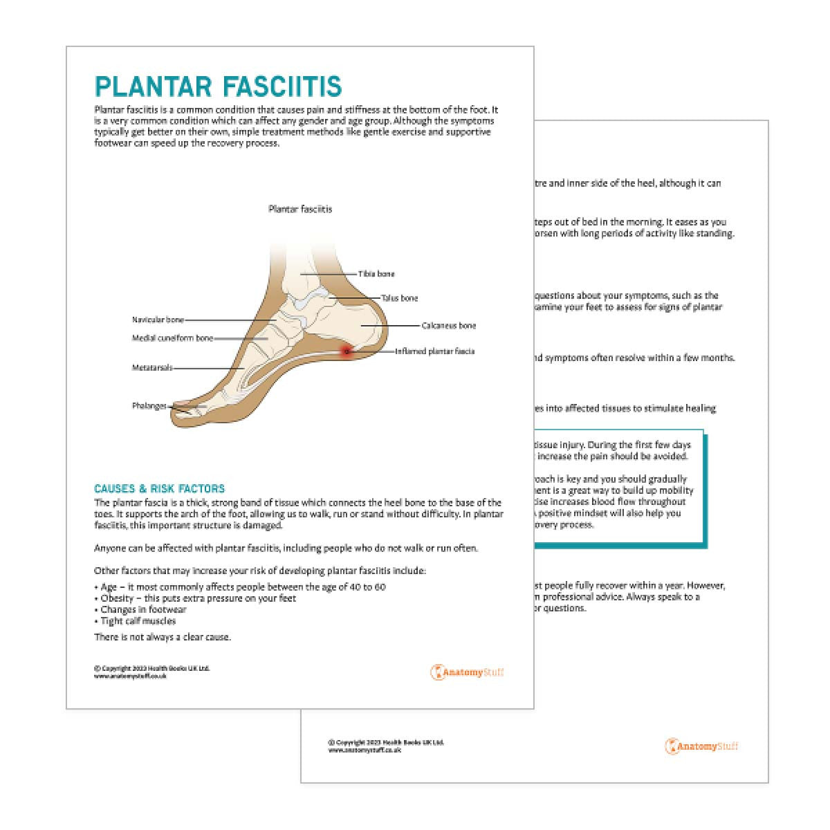 Plantar Fasciitis Patient Education Handout