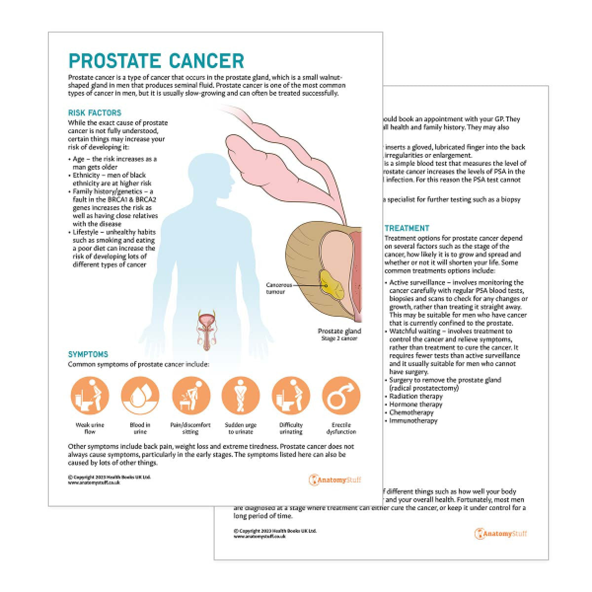 Prostate Cancer Patient Education PDF | Informative Handout Download ...