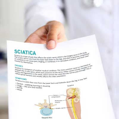 Sciatica Handout Mockup