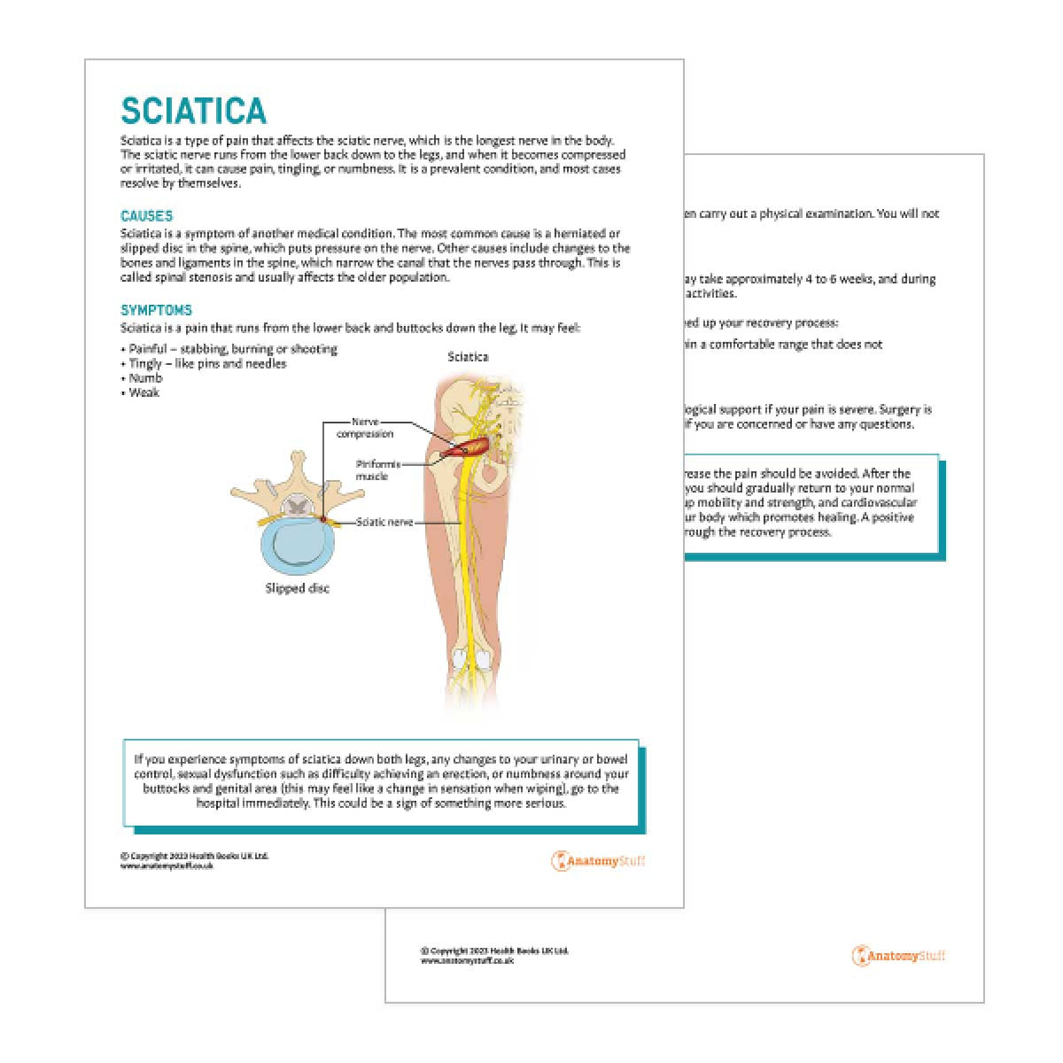 Sciatica Patient Education Handout