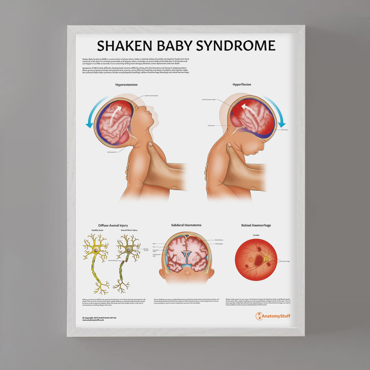The Pathology of a Fragile Beginning