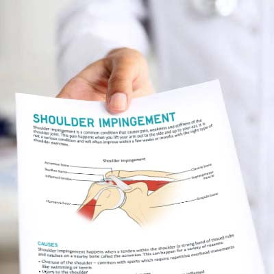 Shoulder Impingement Patient Education Handout (Printable PDF)