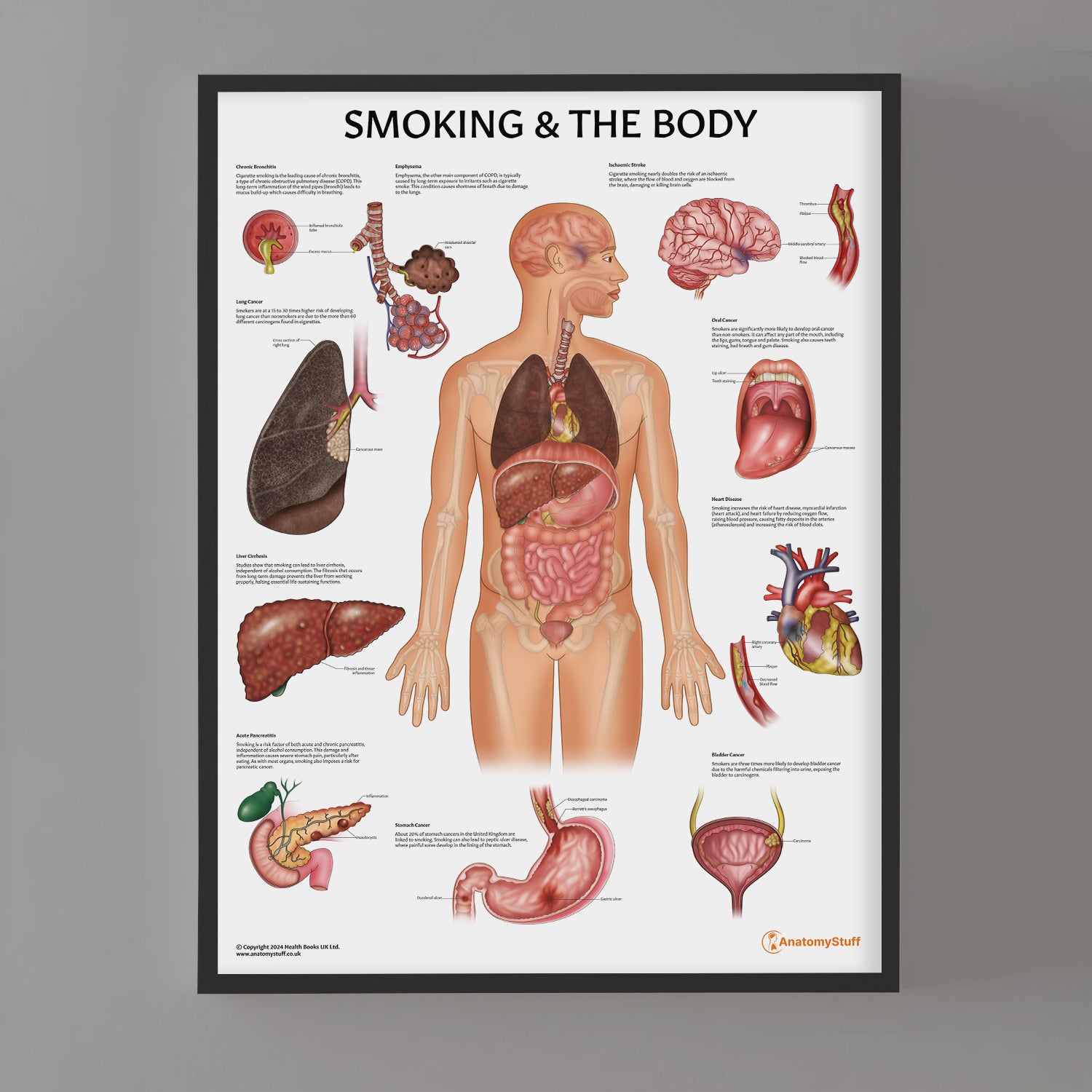 how does smoking cigarettes affect the body Smoking and The Body Chart / Poster how does smoking cigarettes affect the body Smoking and The Body Chart / Poster