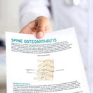 Switch Osteoarthritis of the spine 2 image