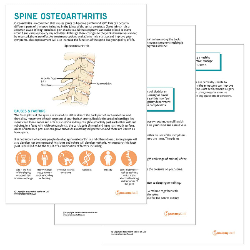 Spine Osteoarthritis Patient Education Handout (Printable PDF)