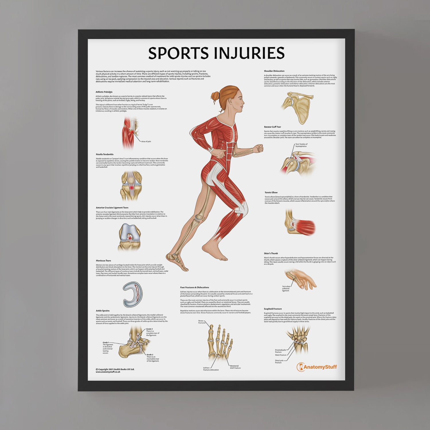 Forensic Physical Injury Chart.pdf Sports Injuries Chart | Fracture, Sprain, Dislocation & Tear Poster ...