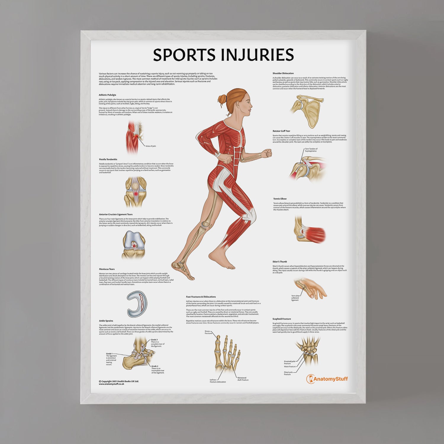 Sports Injuries Chart | Fracture, Sprain, Dislocation & Tear Poster ...
