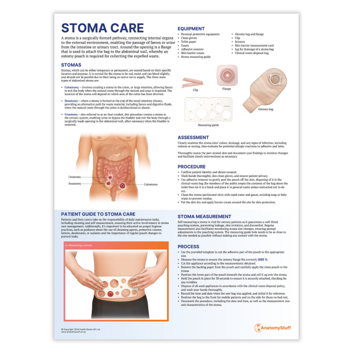 Stoma Care Poster | Ostomy Assessment and Patient Support Chart ...