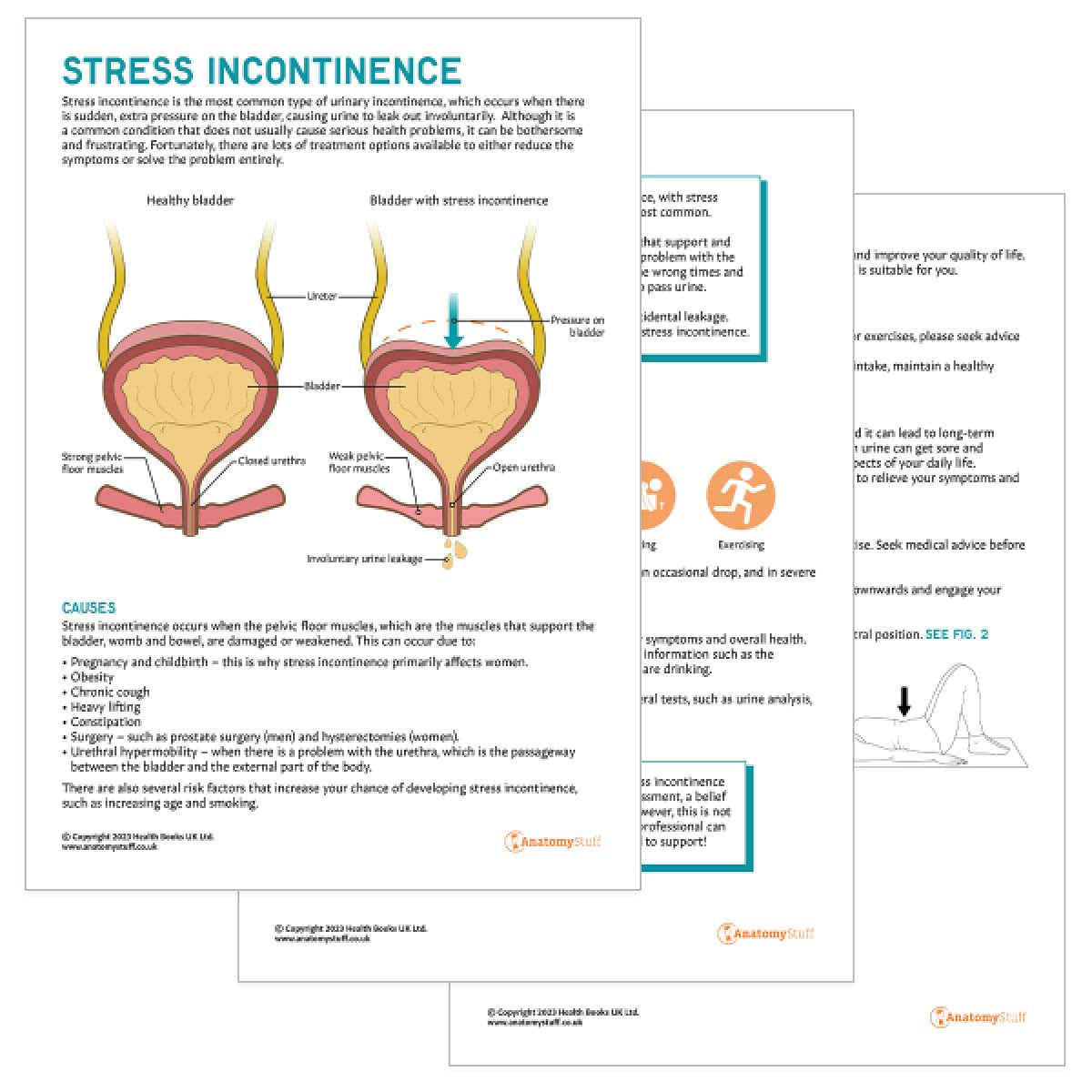 Stress Incontinence Handout PDF | Patient Education Leaflet – AnatomyStuff
