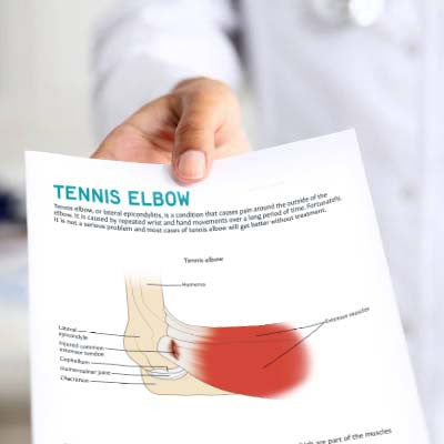 Tennis Elbow Patient Education Handout (Printable PDF)