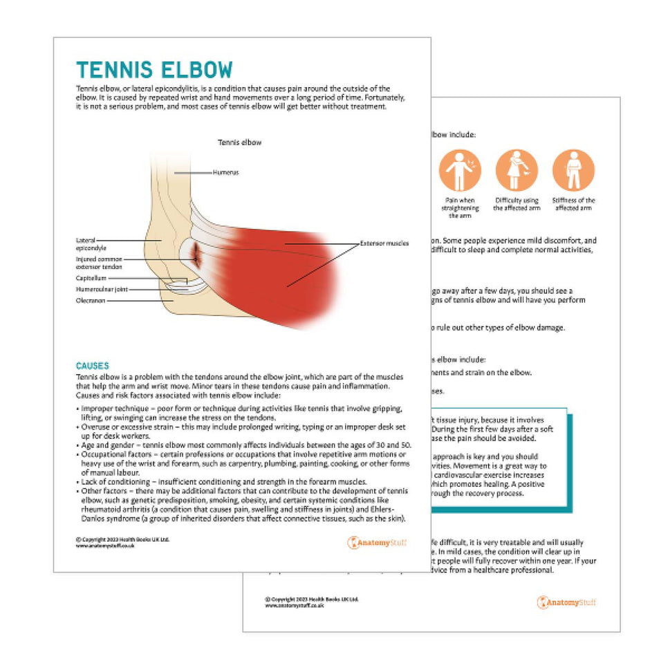 Tennis Elbow Patient Education Handout (Printable PDF)