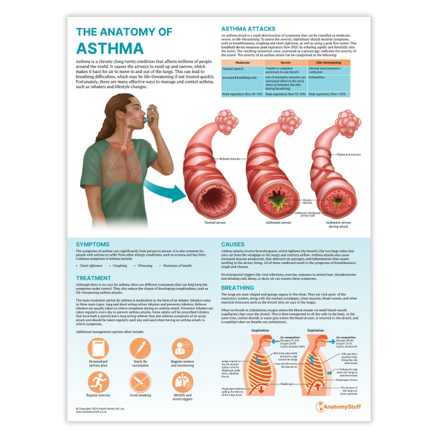 Comprendiendo El Asma Anatomy Poster Clinicalposters
