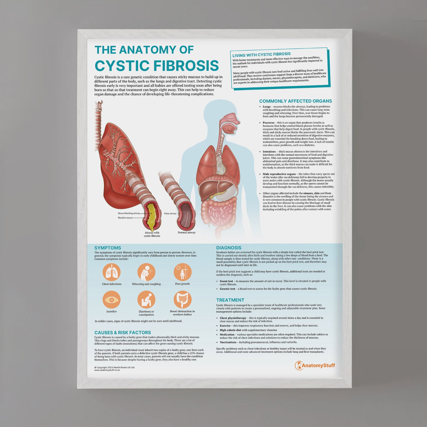 The Anatomy of Cystic Fibrosis Chart | Respiratory Health Poster ...
