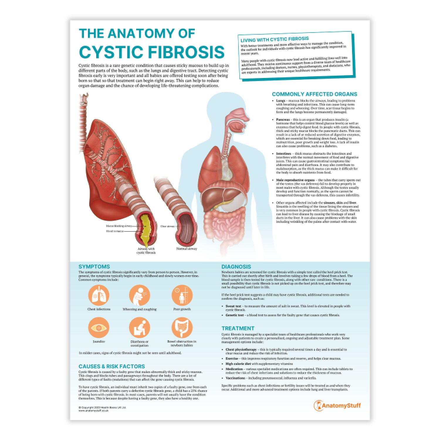 The Anatomy of Cystic Fibrosis Chart | Respiratory Health Poster ...