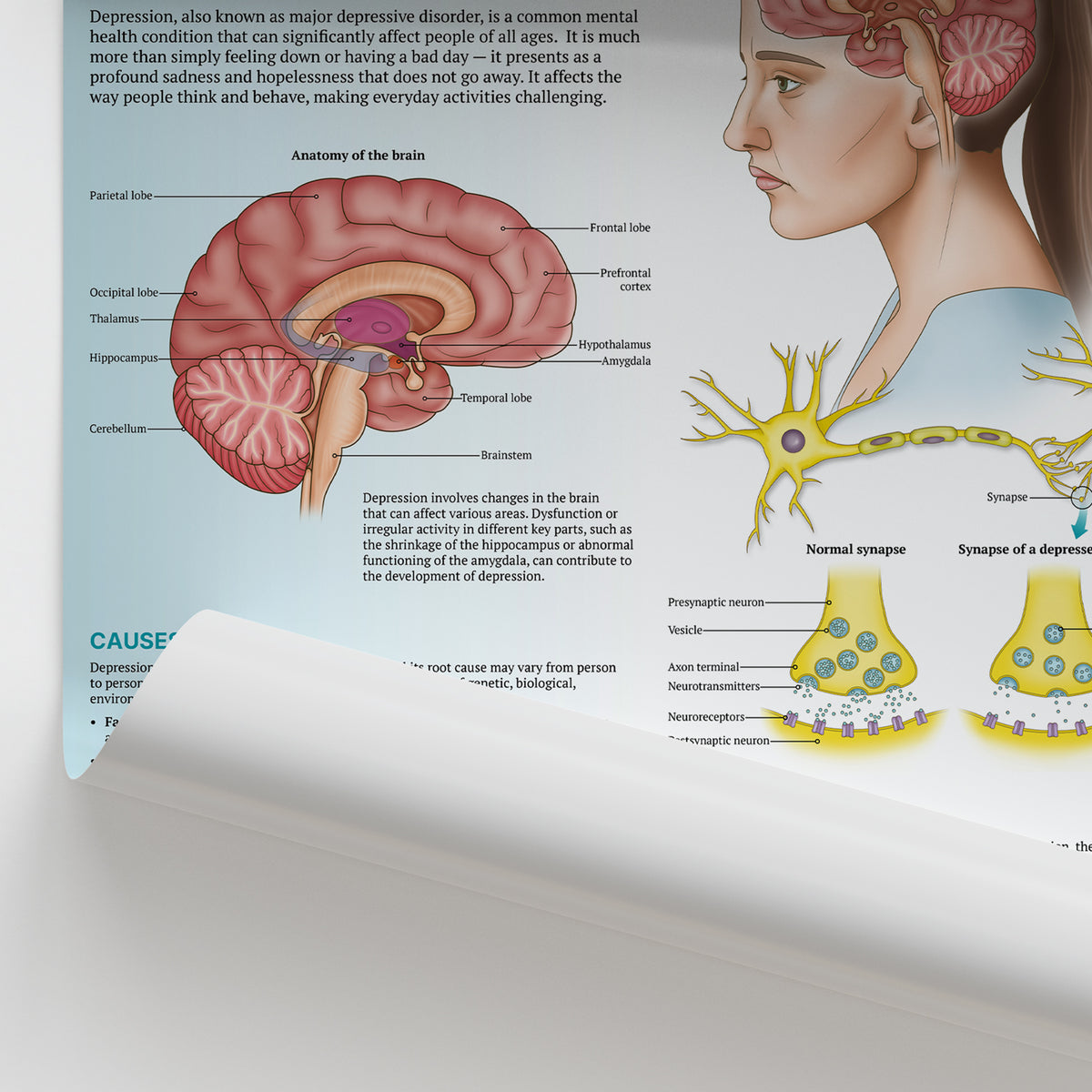 The Anatomy of Depression Chart | Mental Health Poster – AnatomyStuff