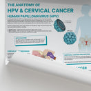 Switch The Anatomy of HPV &amp; Cervical Cancer Chart / Poster 2 image