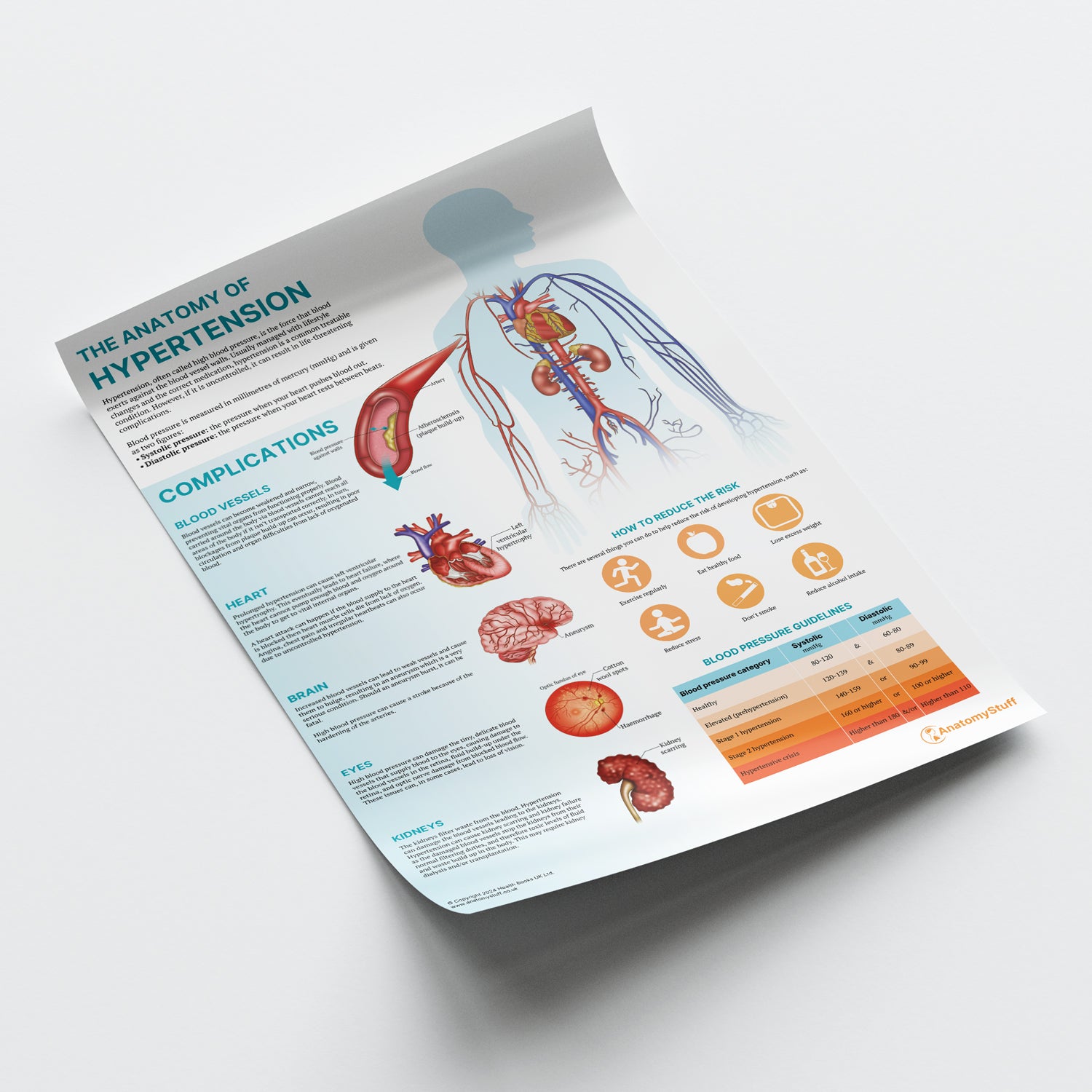 The Anatomy of Hypertension Chart / Poster