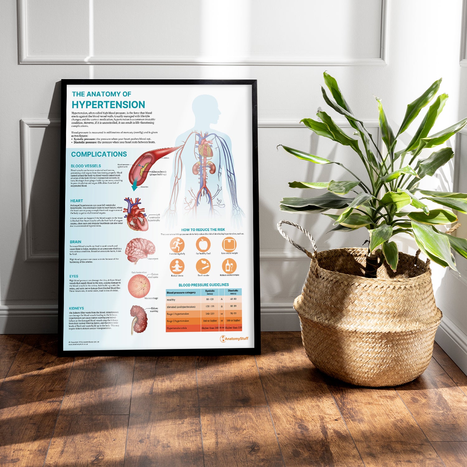 The Anatomy of Hypertension Chart / Poster