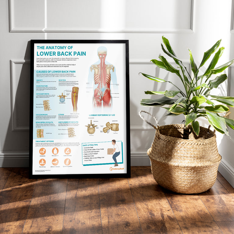 The Anatomy of Lower Back Pain Poster | Patient Education Tool ...