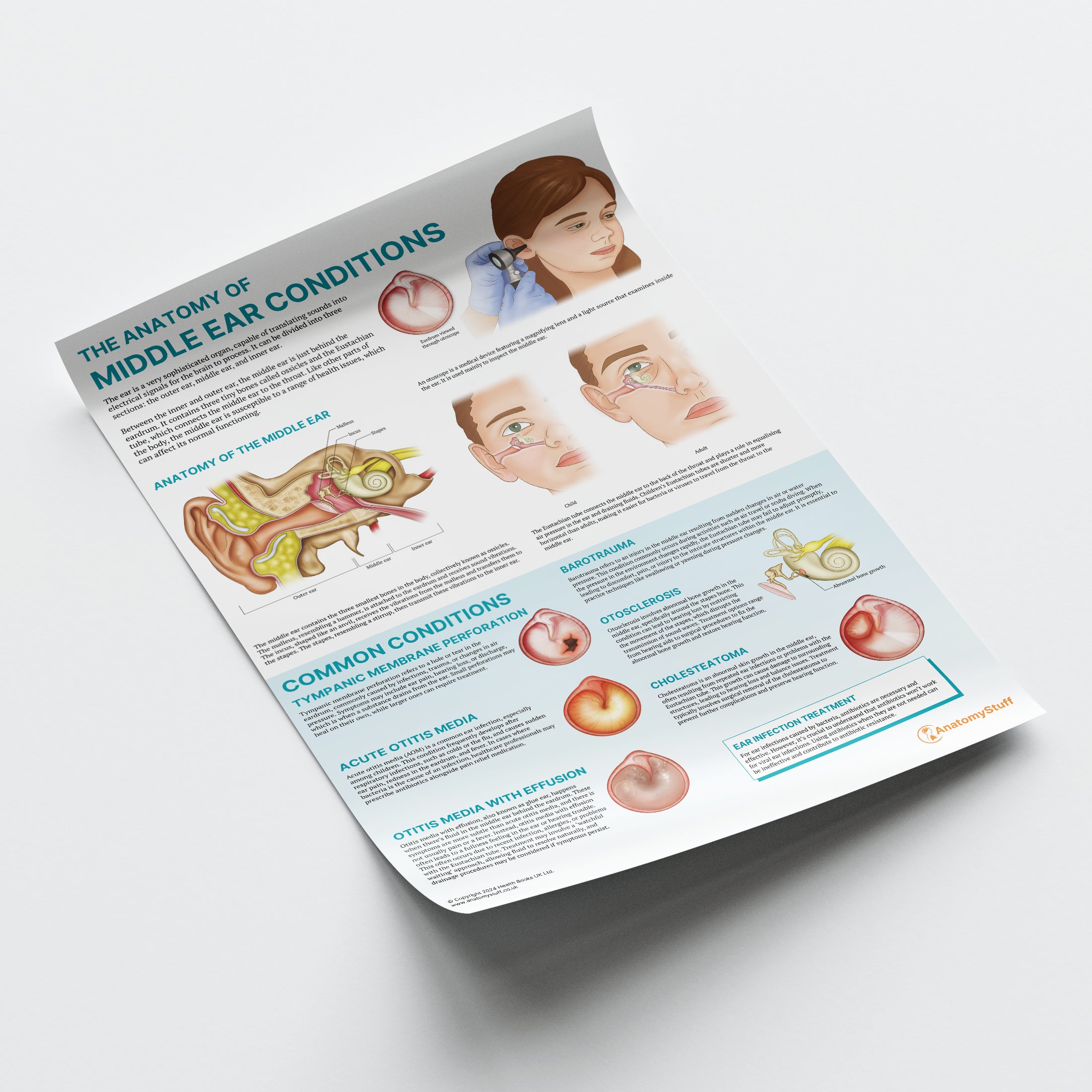 Middle Ear Pathologies The Anatomy of Middle Ear Conditions Poster | ENT Education – AnatomyStuff