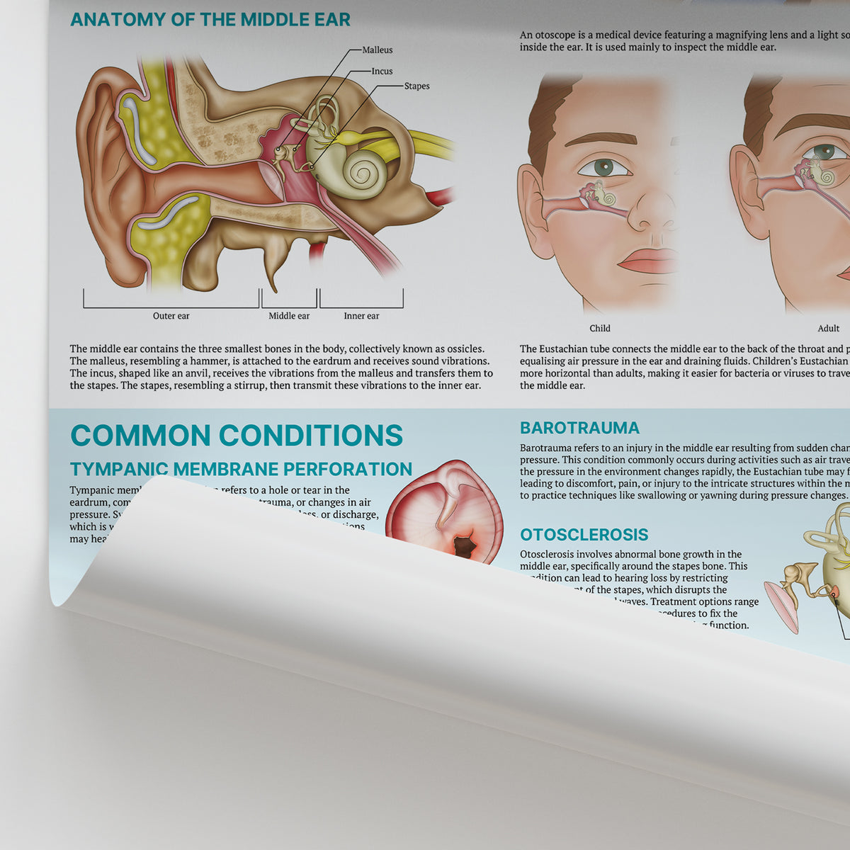 The Anatomy of Middle Ear Conditions Poster | ENT Education – AnatomyStuff