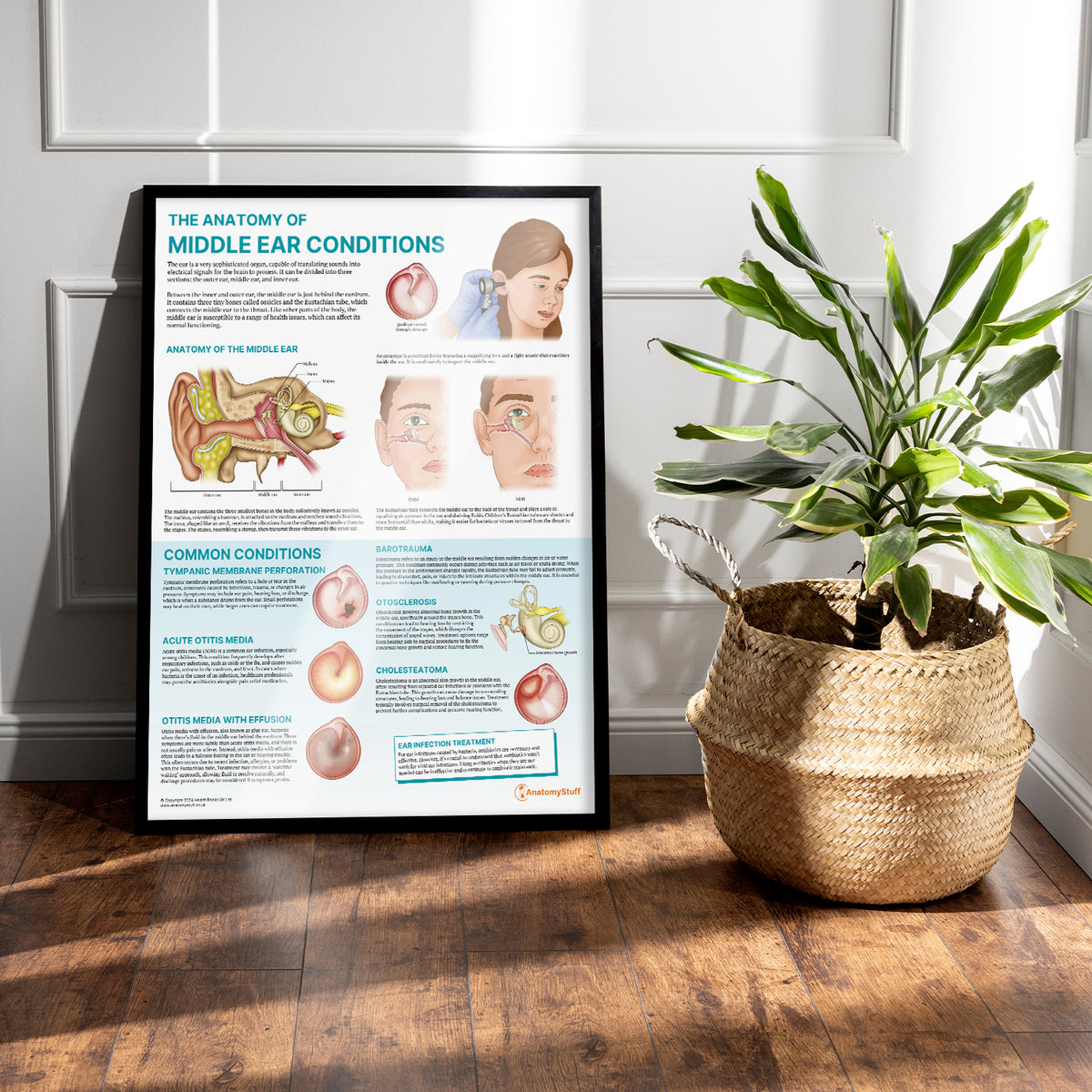 Middle Ear Pathologies The Anatomy of Middle Ear Conditions Poster | ENT Education – AnatomyStuff