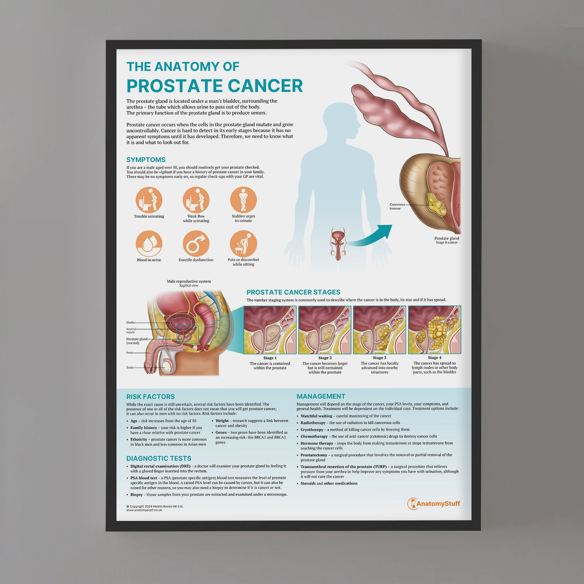 The Anatomy of Prostate Cancer Poster | Male Health Education Chart ...