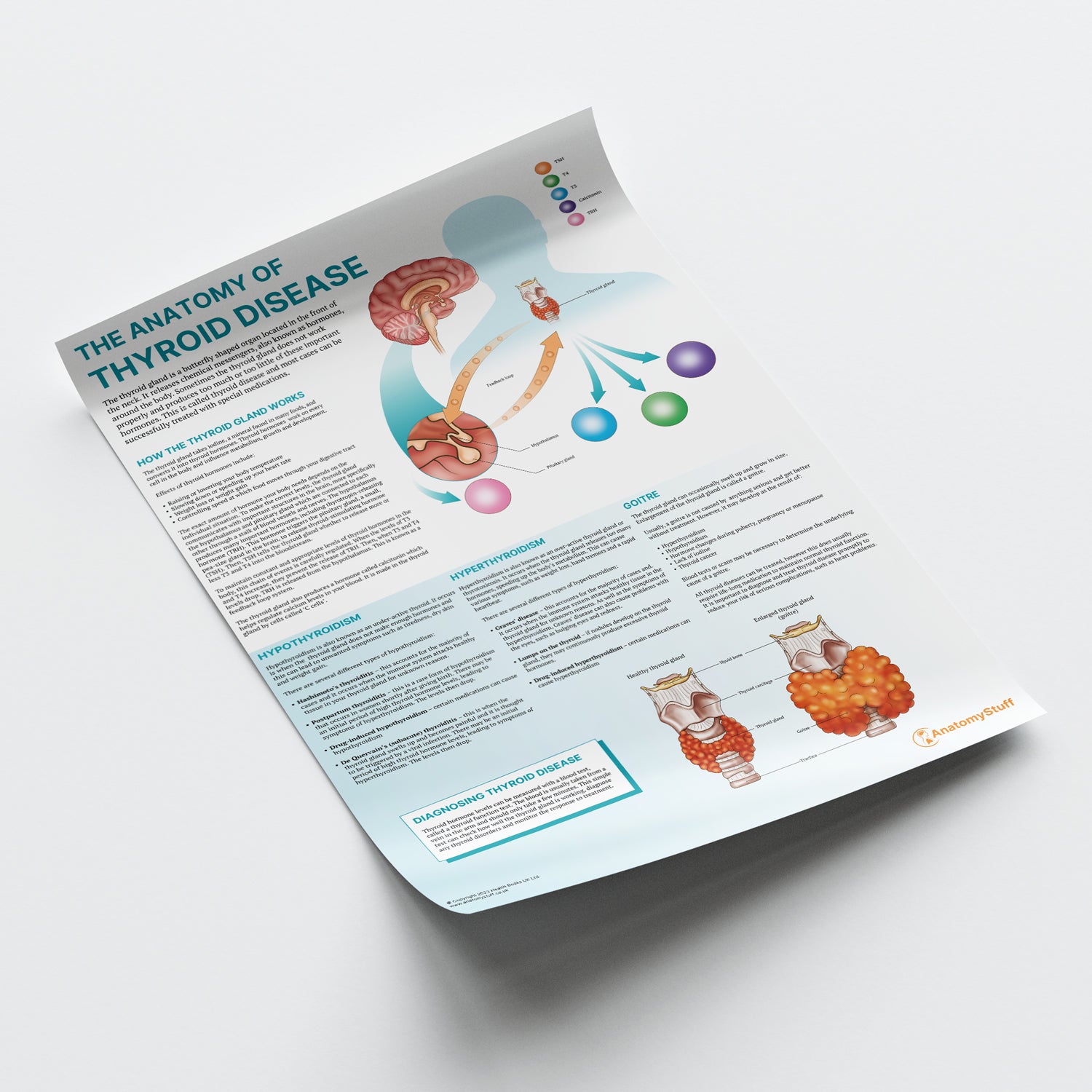 The Anatomy of Thyroid Disease Chart / Poster