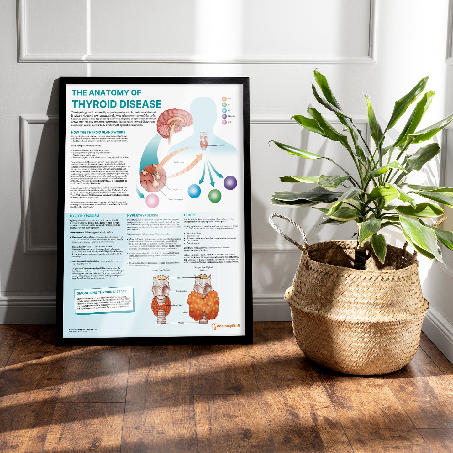 The Anatomy of Thyroid Disease Chart / Poster