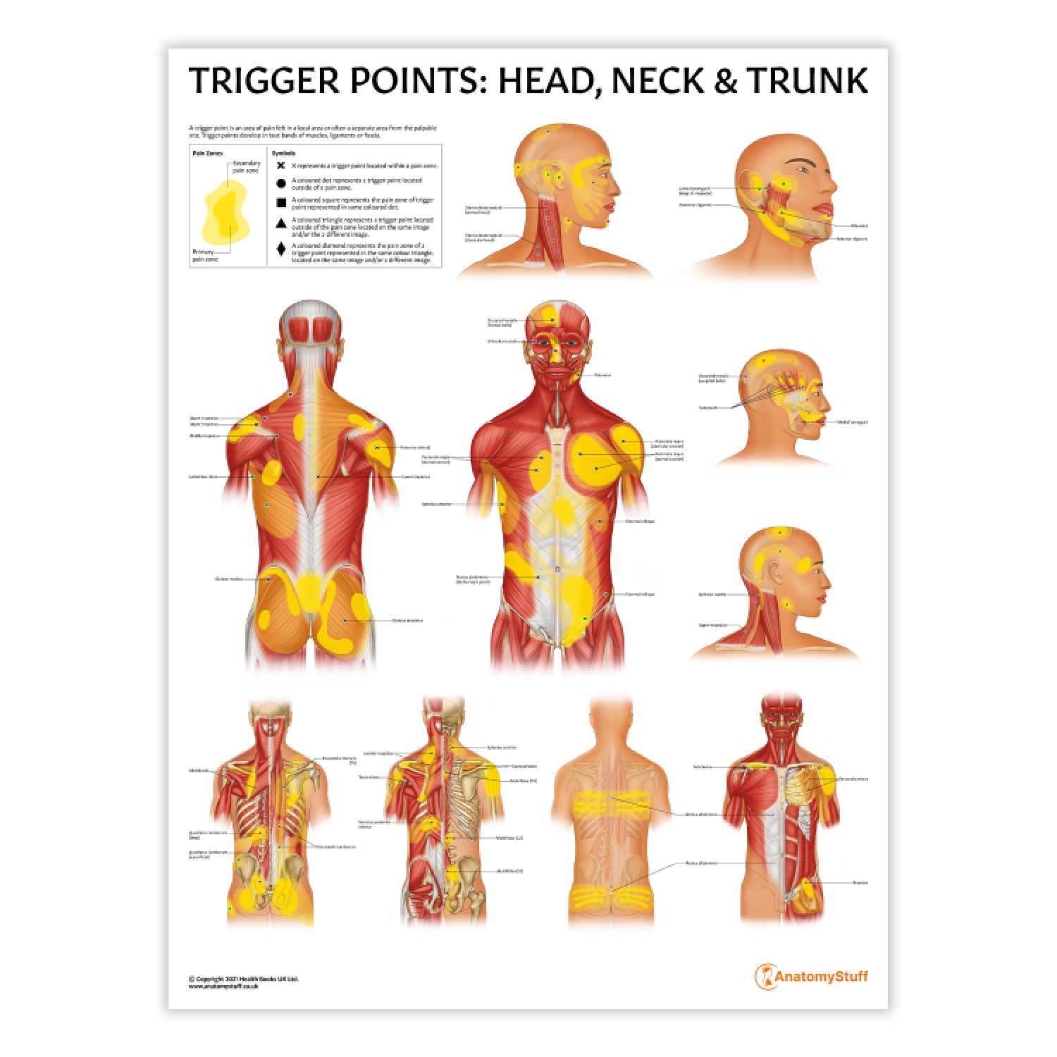 Trigger Points: Head, Neck & Trunk Poster | Myofascial Pain Chart ...