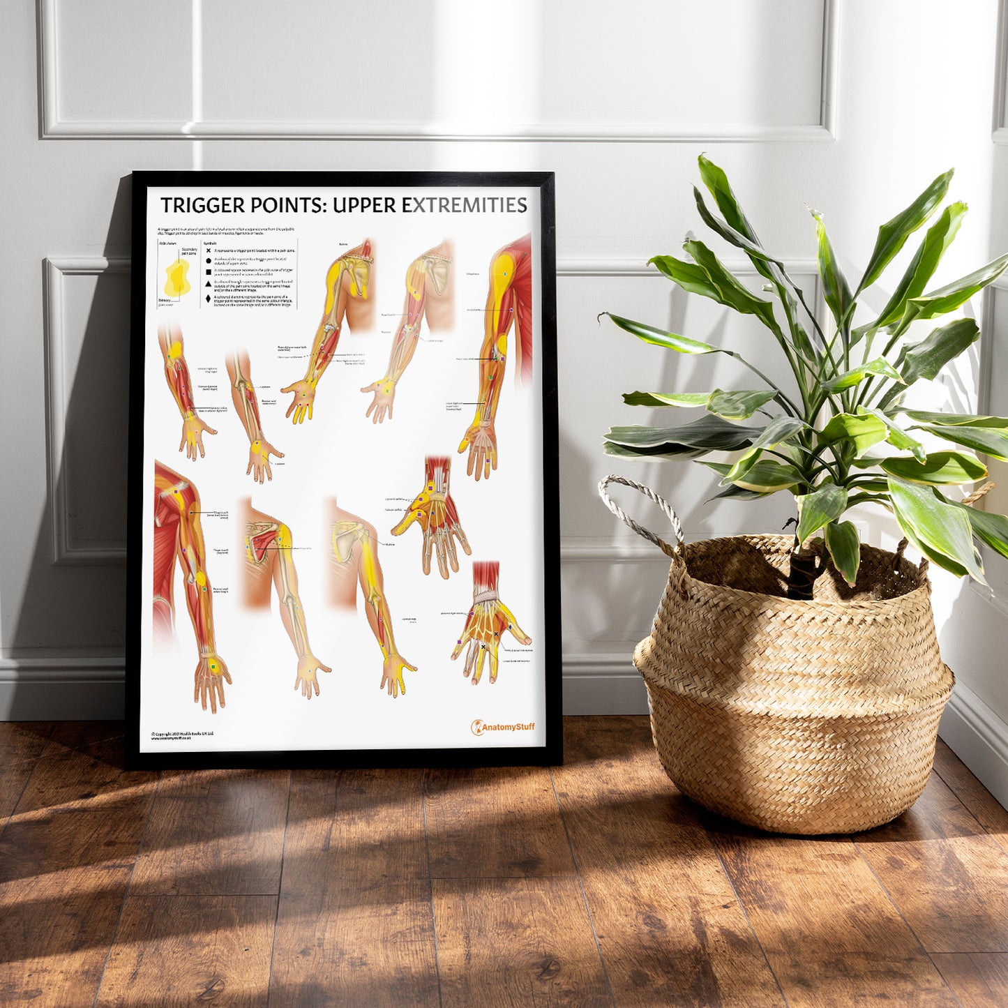 Trigger Points: Upper Extremities Chart / Poster
