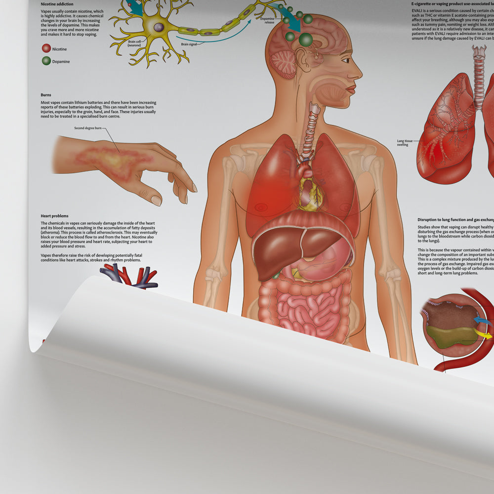 Vaping and the Body Poster | E-Cigarette Health Effects Chart AnatomyStuff Vaping and the Body Poster | E-Cigarette Health Effects Chart AnatomyStuff